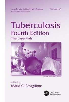 Tuberculosis - 