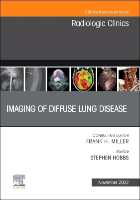 Imaging of Diffuse Lung Disease, An Issue of Radiologic Clinics of North America - 