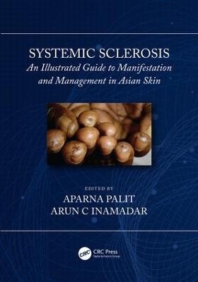 Systemic Sclerosis - 