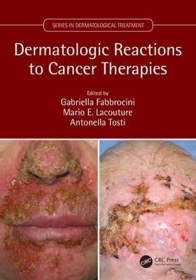 Dermatologic Reactions to Cancer Therapies - 