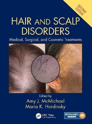 Hair and Scalp Disorders - 