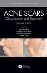 Acne Scars - Tosti, Antonell; Pia De Padova, Maria; Fabbrocini, Gabriella; Beer, Kenneth