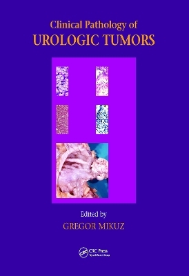 Clinical Pathology of Urological Tumours - 