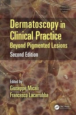 Dermatoscopy in Clinical Practice - 