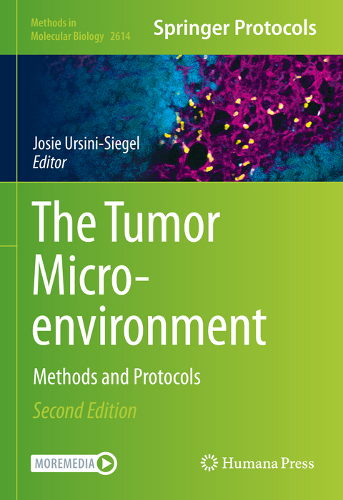 The Tumor Microenvironment - 