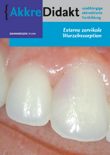 Externe zervikale Wurzelresorption - Athina Mavridou, Jan Warnsinck