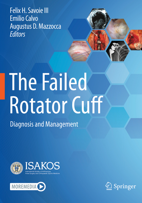 The Failed Rotator Cuff - 