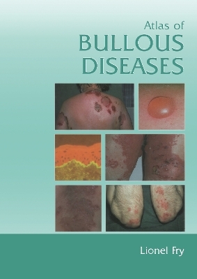 Atlas of Bullous Diseases - Lionel Fry