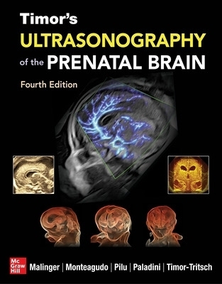 Timor's Ultrasonography of the Prenatal Brain, Fourth Edition - Gustavo Malinger, Ana Monteagudo, Gianluigi Pilu, Ilan Timor-Tritsch, Dario Paladini