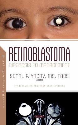 Retinoblastoma: Diagnosis to Management - 