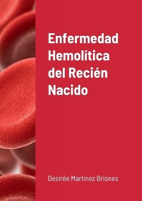 Enfermedad hemolítica del Recién Nacido - Desirée Martínez Briones