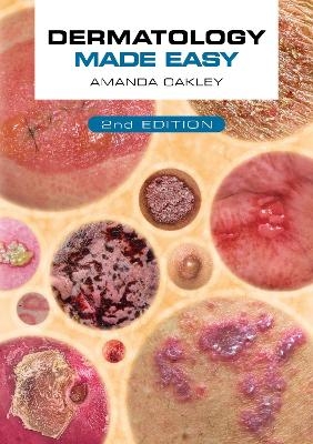 Dermatology Made Easy, second edition - Amanda Oakley