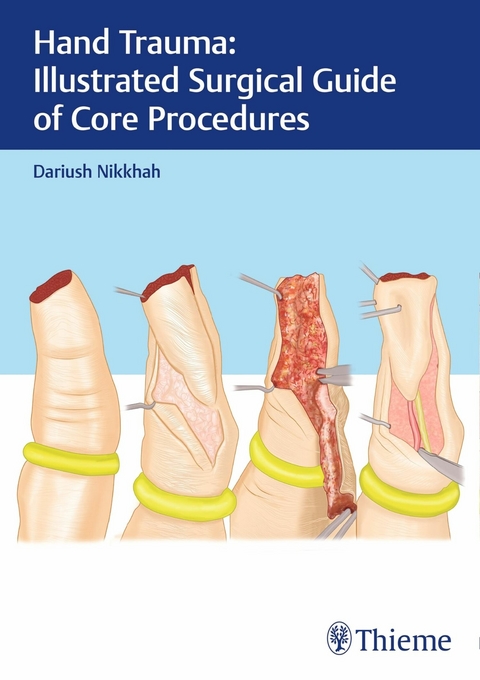 Hand Trauma: Illustrated Surgical Guide of Core Procedures -  Dariush Nikkhah