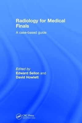 Radiology for Medical Finals - 