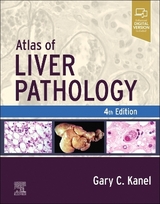 Atlas of Liver Pathology - Kanel, Gary C.