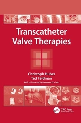 Transcatheter Valve Therapies - Christoph Huber, Ted Feldman