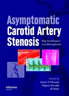 Asymptomatic Carotid Artery Stenosis - 