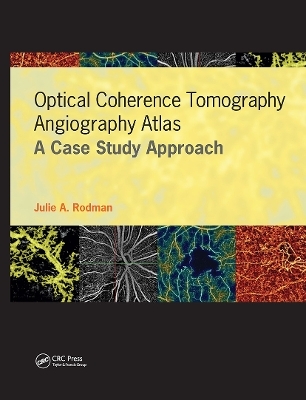 Optical Coherence Tomography Angiography Atlas - JULIE RODMAN, Dan Esmaili