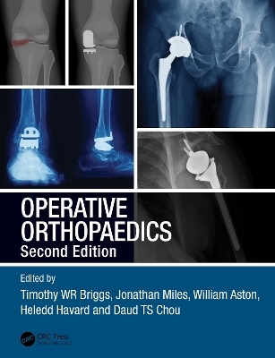 Operative Orthopaedics - 