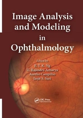 Image Analysis and Modeling in Ophthalmology - 