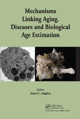 Mechanisms Linking Aging, Diseases and Biological Age Estimation - 