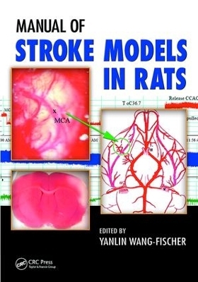 Manual of Stroke Models in Rats - 