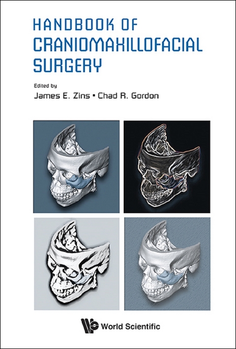 HANDBOOK OF CRANIOMAXILLOFACIAL SURGERY - 