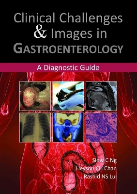 Clinical Challenges & Images in Gastroenterology - Dr Siew C Ng, Dr Heyson CH Chan, Dr Rashid NS Lui