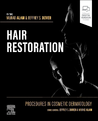 Procedures in Cosmetic Dermatology: Hair Restoration - Murad Alam, Jeffrey S. Dover