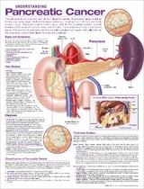 Understanding Pancreatic Cancer Anatomical Chart - 