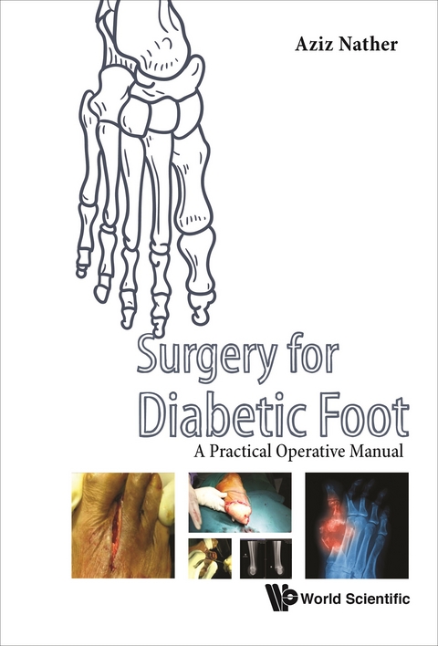 Surgery For Diabetic Foot: A Practical Operative Manual - 