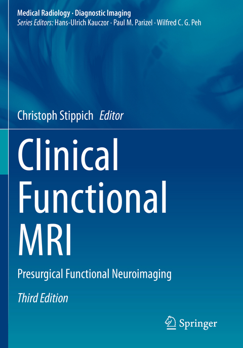 Clinical Functional MRI - 