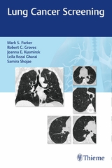 Lung Cancer Screening -  Mark Parker,  Robert Groves,  Joanna Kusmirek,  Leila Rezai Gharai,  Samira Shojaee