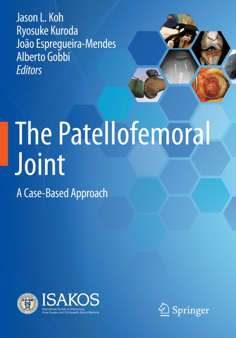 The Patellofemoral Joint - 