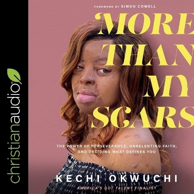 More Than My Scars - Kechi Okwuchi