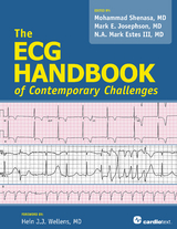 The ECG Handbook of Contemporary Challenges - III Estes N. A. Mark,  Mark E. Josephson,  Mohammad Shenasa