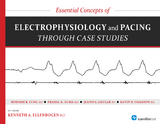 Essential Concepts of Electrophysiology and Pacing through Case Studies -  Kenneth A. Ellenbogen,  Prabal Guha,  Roderick Tung