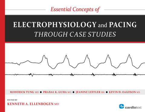 Essential Concepts of Electrophysiology and Pacing through Case Studies -  Kenneth A. Ellenbogen,  Prabal Guha,  Roderick Tung