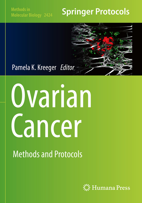 Ovarian Cancer - 