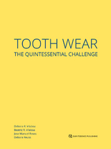 Tooth Wear - Débora R. Vilaboa, Beatriz R. Vilaboa, Jose Manuel Reuss, Débora Reuss