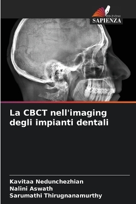 La CBCT nell'imaging degli impianti dentali - Kavitaa Nedunchezhian, Nalini Aswath, Sarumathi Thirugnanamurthy