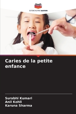 Caries de la petite enfance - Surabhi Kumari, Anil Kohli, Karuna Sharma