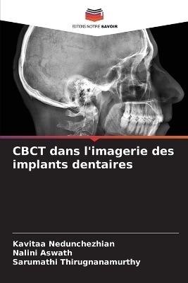 CBCT dans l'imagerie des implants dentaires - Kavitaa Nedunchezhian, Nalini Aswath, Sarumathi Thirugnanamurthy