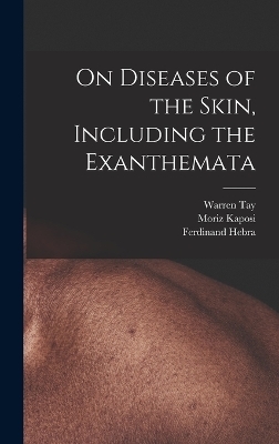 On Diseases of the Skin, Including the Exanthemata - Moriz Kaposi, Ferdinand Hebra, Warren Tay