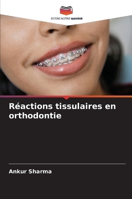 Réactions tissulaires en orthodontie - Ankur Sharma