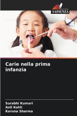 Carie nella prima infanzia - Surabhi Kumari, Anil Kohli, Karuna Sharma