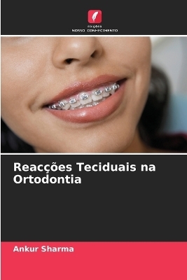 Reacções Teciduais na Ortodontia - Ankur Sharma