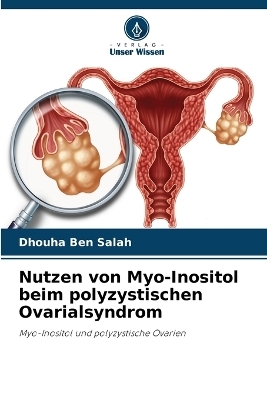 Nutzen von Myo-Inositol beim polyzystischen Ovarialsyndrom - Dhouha Ben Salah