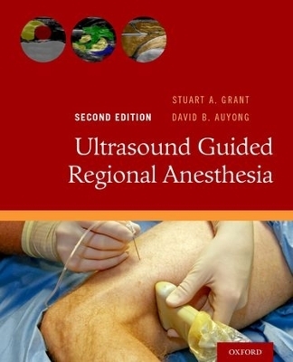 Ultrasound Guided Regional Anesthesia - 