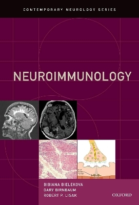 Neuroimmunology - 